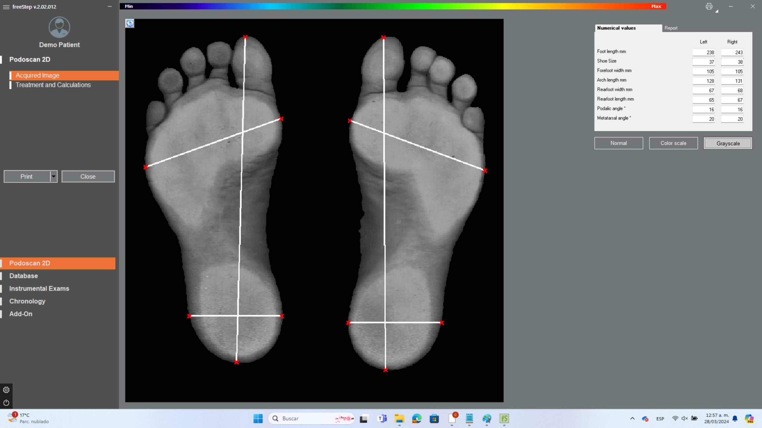 2D Digital Scan of foot - Podoscan 2D - Sensor Medica